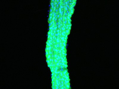 Hindgut